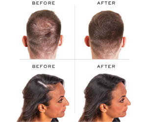 Nanogen Hair Thickening Fibres 30g Medium Brown Ab 20 36 Preisvergleich Bei Idealo De