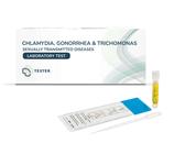 Chlamydien- & Gonorrhö-Test - Mann